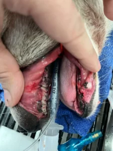 Dental Extraction Closeup